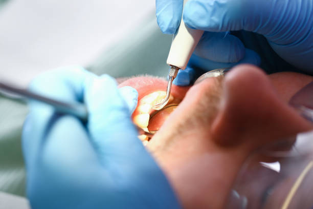 Best Walk-In Emergency Dentist in Dunlap, OH
